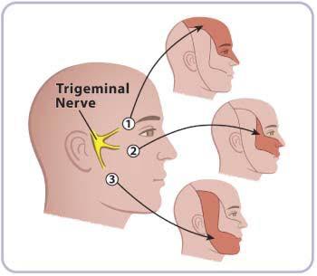 Non-Invasive Treatment For Neuralgia
