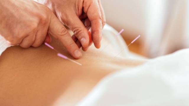 Acupuncture For IVF/Infertility TTC